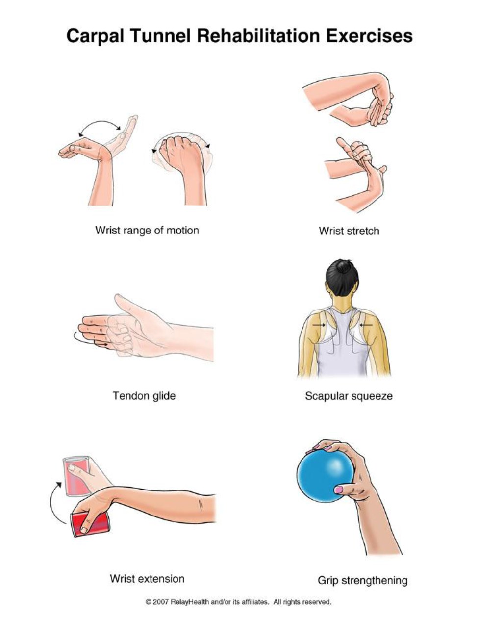 Carpal Tunnel Syndrome rehabilitation exercises illustration