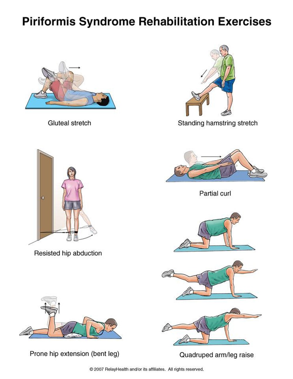 Piriformis Syndrome rehabilitation exercises illustration