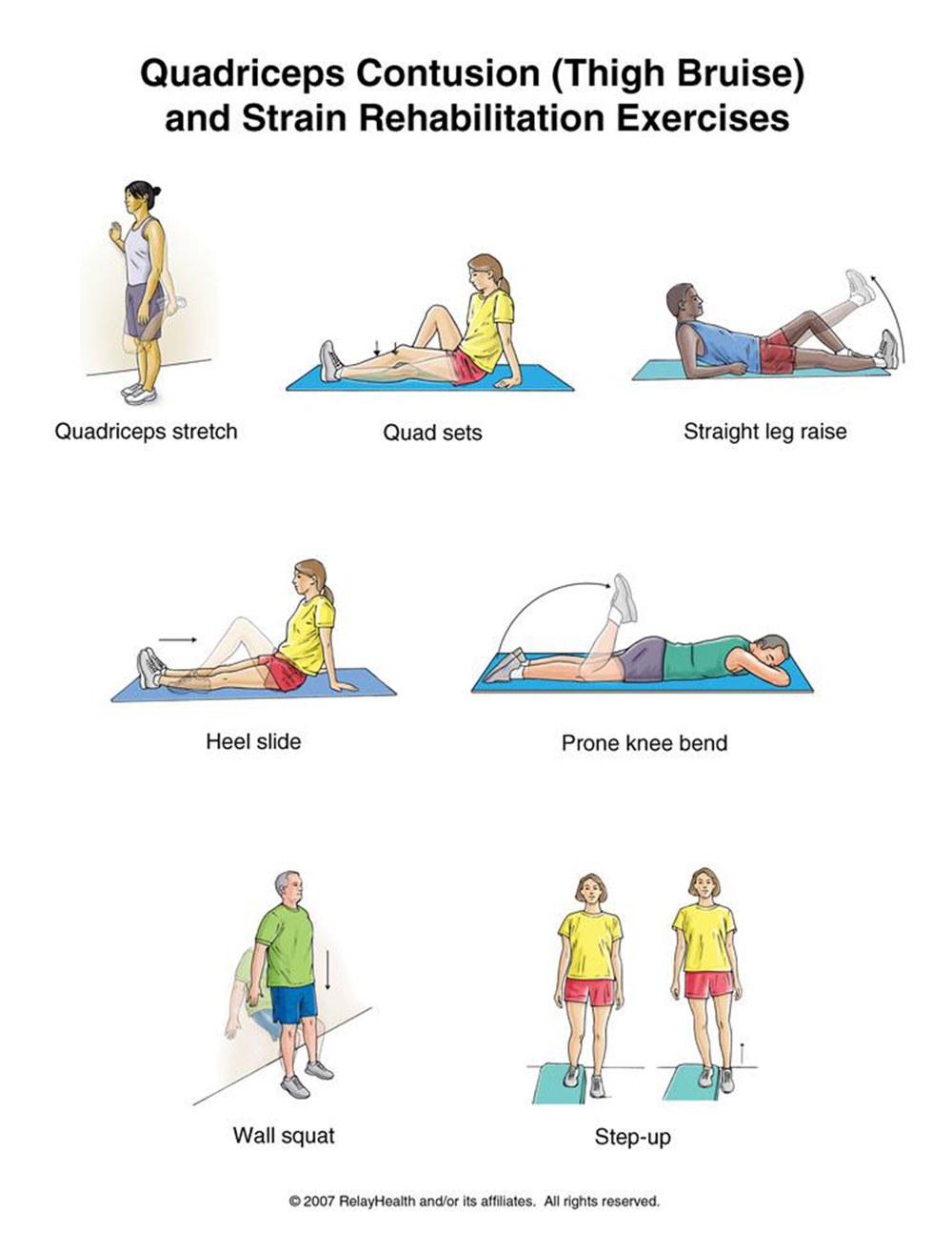 Quadriceps Contusion or Strain rehabilitation exercises illustration