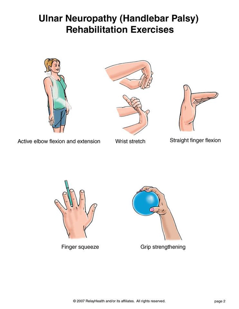 Ulnar Neuropathy rehabilitation exercises illustration